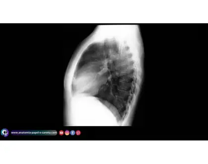 Coração por RX - Perfil 1
