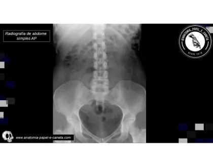Digestório por RX - 9