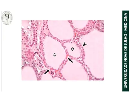 Histologia da glândula tireóide
