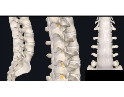 Ligamentos da coluna - 1