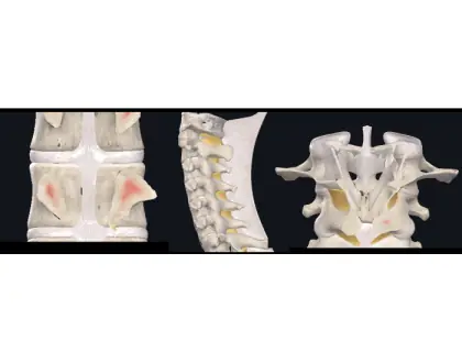 Ligamentos da coluna - 2