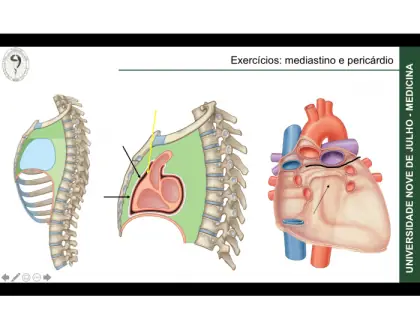 Mediastino - 2