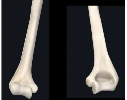 Úmero distal
