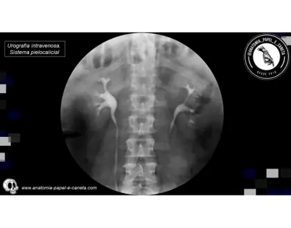 Urinário - RX - 1