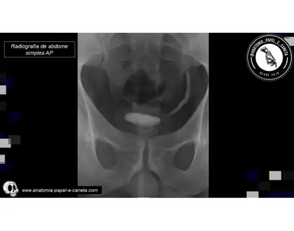 Urinário - RX - 2