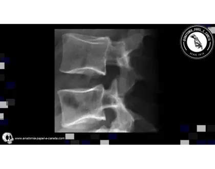 Coluna vertebral por RX - 2